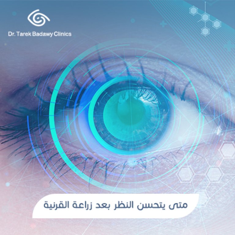متى يتحسن النظر بعد زراعة القرنية